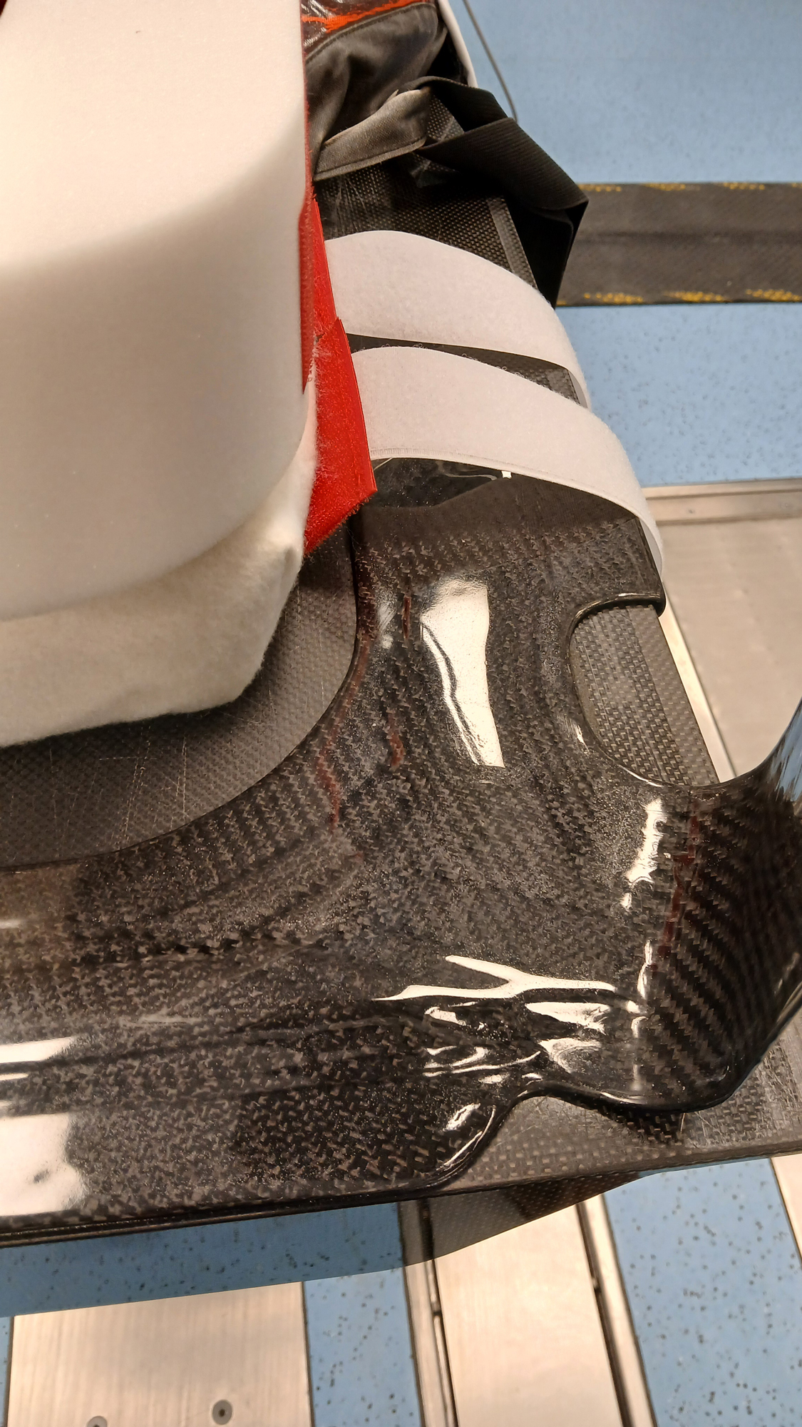 rigshospitalet-bøjle